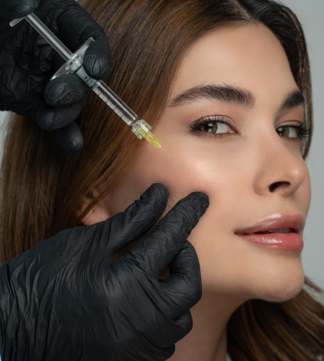 Dermal filler treatment at IUVENTUS MEDICAL CENTER Las Vegas