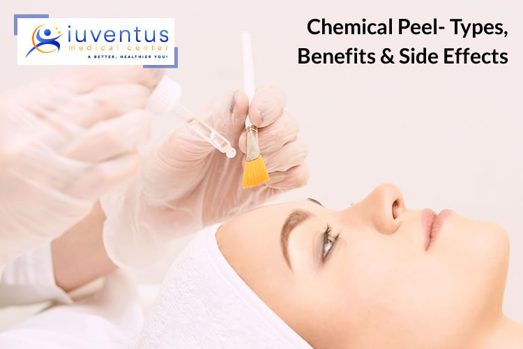 Chemical Peel- Types, Benefits & Side Effects