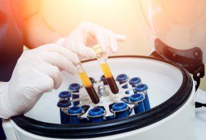 how prp works in Las Vegas and Herderson, NV