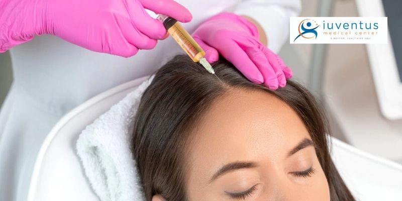 PRP Injection for treatment of hair-fall 