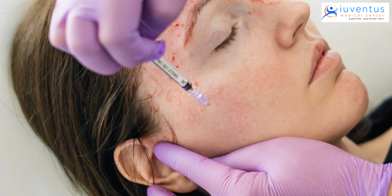 How can you rejuvenate your facial skin with PRP Therapy