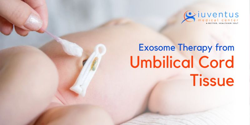 Exosome Therapy from Umbilical Cord Tissue