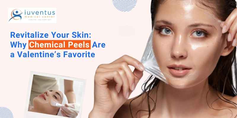 Chemical Peels