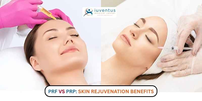 PRF vs PRP Skin Rejuvenation