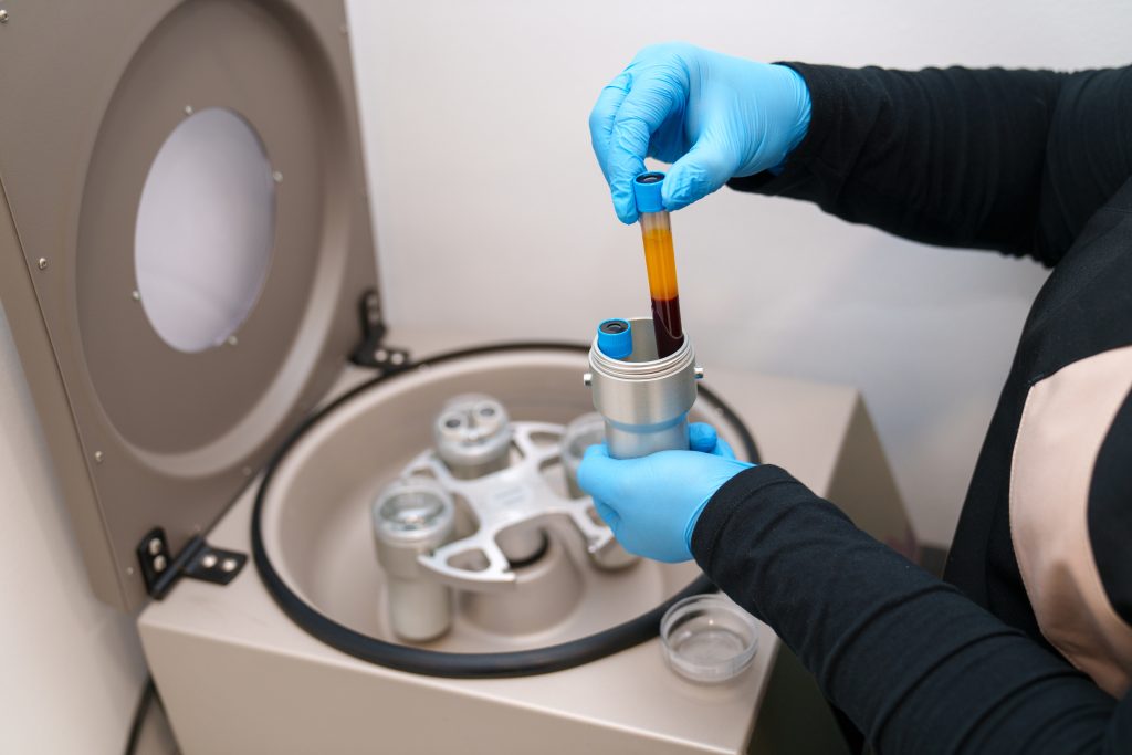 the Power of PRP in Las Vegas andHenderson, NV
